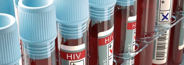 NASCONDE DI AVERE L’HIV E HA UN RAPPORTO NON PROTETTO, ABRUZZESE ARRESTATO A BARI