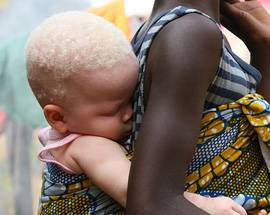 PALERMO: FIGLIO BIANCO E CON OCCHI CHIARI DA COPPIA NIGERIANA