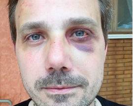 TAGLIACOZZO: ATTIVISTA DEL M5S PESTATO A SANGUE DA TRE INCAPPUCCIATI