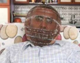 NON RIESCE A SMETTERE DI FUMARE: SI CHIUDE LA TESTA IN UNA GABBIA