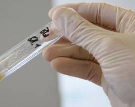 PER ELUDERE ANTIDOPING SI PRESENTA AL CONTROLLO CON PENE FINTO RIEMPITO DI URINA ”PULITA”