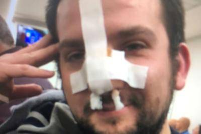 AQUILANO AGGREDISCE COPPIA E ROMPE IL NASO A UN GIORNALISTA