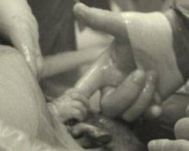 STRINGE DITO DEL MEDICO, FOTO NEONATA FA GIRO DEL MONDO