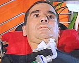 CALCIO IN LUTTO: MORTO BORGONOVO, L’EX BOMBER DEL PESCARA AVEVA LA SLA