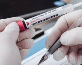 CORONAVIRUS: ZERO CONTAGI IN SEI REGIONI