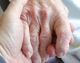 CORONAVIRUS: TRIVULZIO, ATTESO INIZIO TESTIMONIANZE MEDICI E OPERATORI