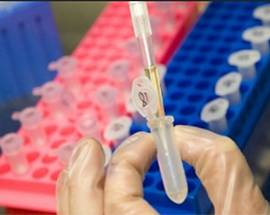 CORONAVIRUS: DA PIACENZA UNA ‘CABINA’ PER TAMPONI RAPIDI