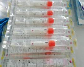 CORONAVIRUS: IN CALABRIA PER LA PRIMA VOLTA ZERO CONTAGI