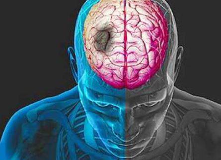 L’AQUILA: ICTUS CEREBRALE, PRIMO CONGRESSO REGIONALE NEUROLOGI E CARDIOLOGI