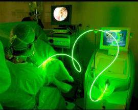 UROLOGIA: ALL’OSPEDALE DI AVEZZANO CON NUOVO LASER NON SERVE CHIRURGIA