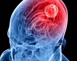 MENINGITE, COSA C’E’ DA SAPERE ECCO LE DOMANDE E LE RISPOSTE IN UN DOCUMENTO DELL’ISS