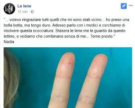 NADIA TOFFA SU FACEBOOK DOPO MALORE, ”BELLA BOTTA, MA TORNO PRESTO”