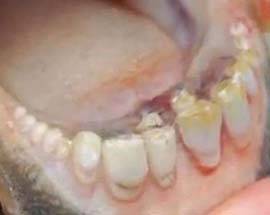 SCOPERTO NUOVO PESCE, SI CHIAMA PACU, HA 32 DENTI E MORDE AI TESTICOLI