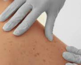 CORONAVIRUS: AD AVEZZANO ANNULLATO OPEN DAY SU PSORIASI