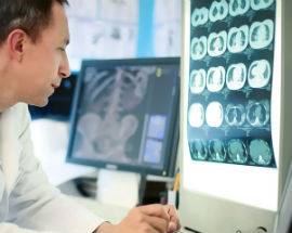 DIAGNOSTICA RADIOLOGICA, ECCO L’ARTOSCAN A CASTEL DI SANGRO