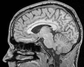 OSPEDALE L’AQUILA: ARRIVA RISONANZA MAGNETICA ‘TOP’ DI ULTIMISSIMA GENERAZIONE