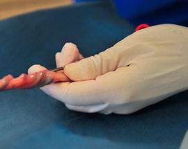 ASL TERAMO: BIMBO APPENA NATO E’ DONATORE DI SANGUE CORDONALE