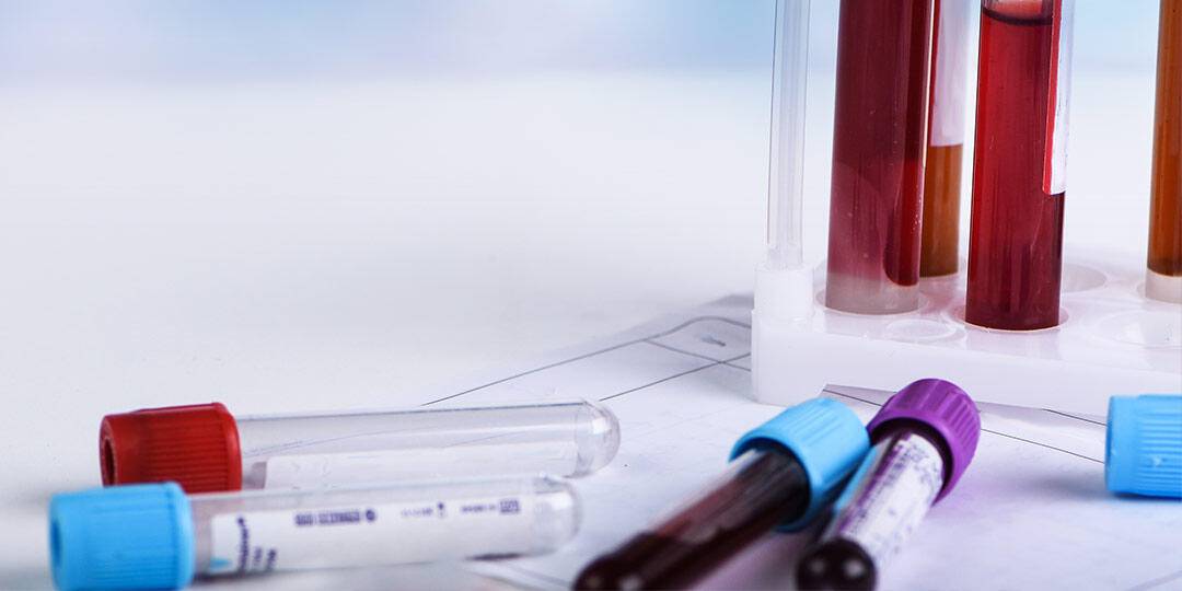 COVID: SINDACO DI LUCOLI REVOCA ORDINANZA “ZONA ROSSA”
