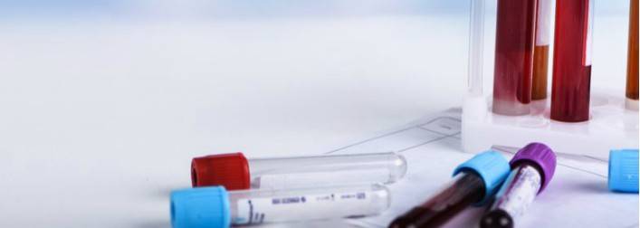 CORONAVIRUS E GRUPPO SANGUIGNO: CHI E’ PIU’ A RISCHIO, LO STUDIO