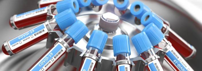 SI PUNTA SU UN FARMACO ANTI-CORONAVIRUS CON ANTICORPI