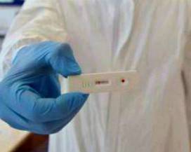 TEST SIEROLOGICI E TAMPONI IN 24 ORE: PRONTO PROTOCOLLO DMC ALTO SANGRO