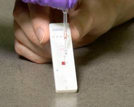 SCUOLA: POSTAZIONI IN OSPEDALE PESCARA PER TEST SIEROLOGICI