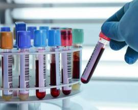 CORONAVIRUS: STOP RICERCA SUL SANGUE DEL PAESE SENZA CONTAGI