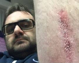 L’AQUILA: VALLONIO, RAPINA SVENTATA ”POTEVANO UCCIDERCI”