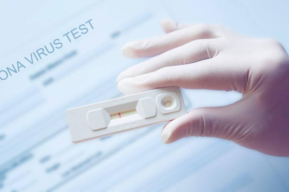 SCUOLA: VIA LIBERA CTS A TEST RAPIDI PER SCREENING
