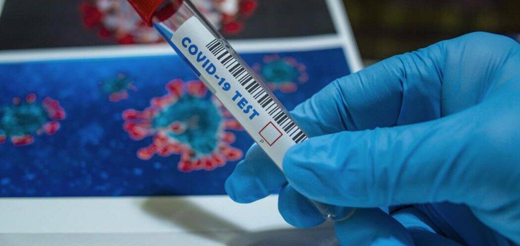 COVID: “IN ABRUZZO TRACCIAMENTO FUNZIONA”, AL 42 PER CENTO POSITIVI
