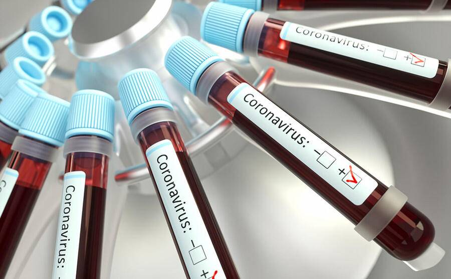 COVID ABRUZZO: 6 CASI, NESSUN MORTO E 27 GUARITI. CON GREEN PASS DECOLLANO I VACCINI