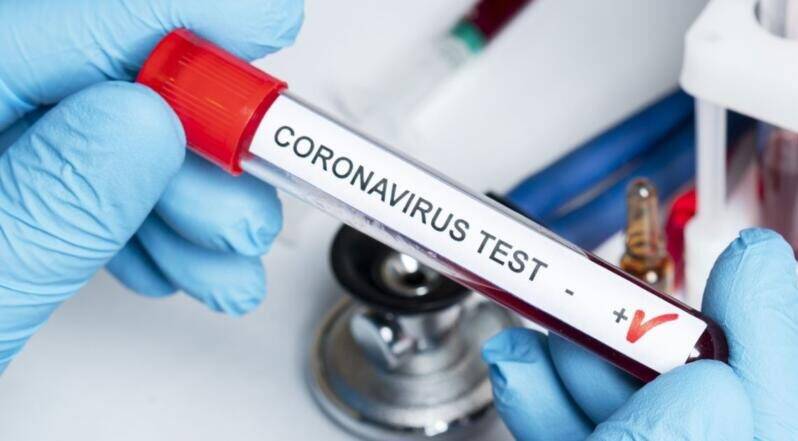 COVID ABRUZZO: 72 CASI, 5 DECESSI E 385 GUARITI. COPRIFUOCO ALLE 23, A GIUGNO NUOVO TAGLIANDO