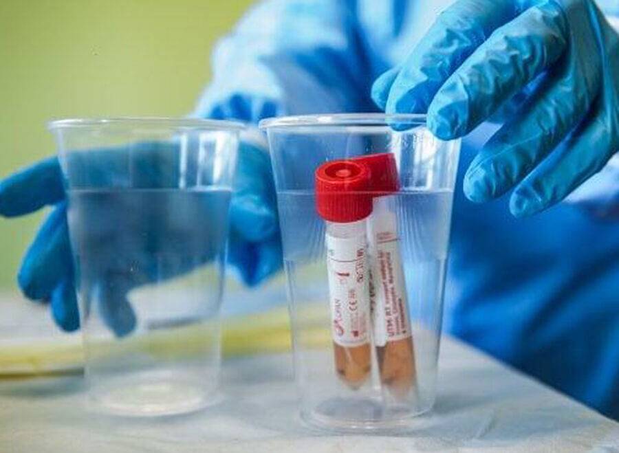 COVID, ABRUZZO PRIMO IN ITALIA PER SEQUENZIAMENTO DEL VIRUS