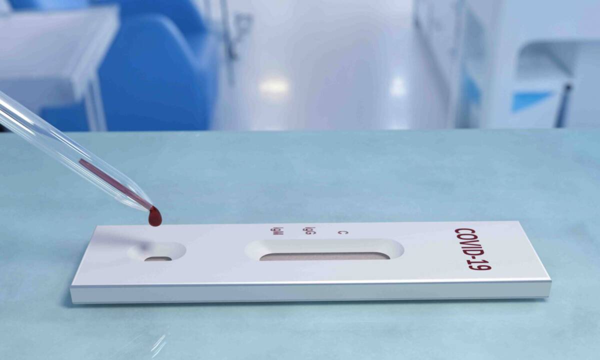 COVID: GALLI, “ORA TEST ANTICORPI PER EVITARE SECONDE DOSI VACCINI NON NECESSARIE”