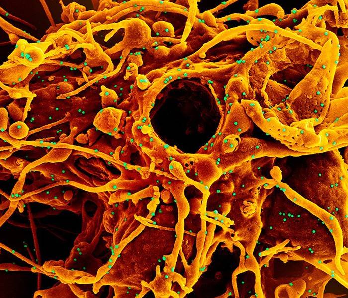 COVID: IN NOVE REGIONI E’ ARRIVATA VARIANTE OMICRON BA2,