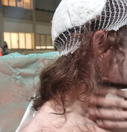 AGGRESSIONE OMOFOBA A BARI: 19ENNE PESCARESE, “VOLEVANO UCCIDERCI, ORA HO PAURA”