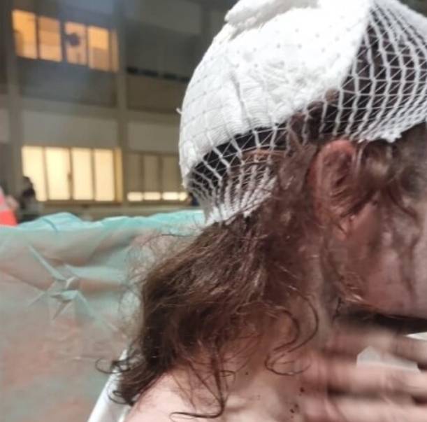 “AGGRESSIONE OMOFOBA A BARI”: FERITO 19ENNE ABRUZZESE, ACQUISITI VIDEO