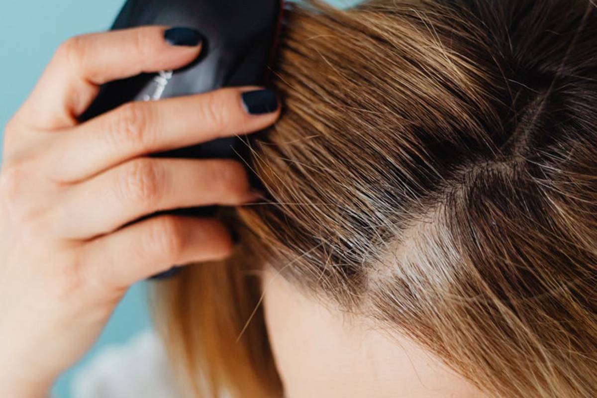 COSA PROVOCA LA CADUTA DEI CAPELLI NELLE DONNE?