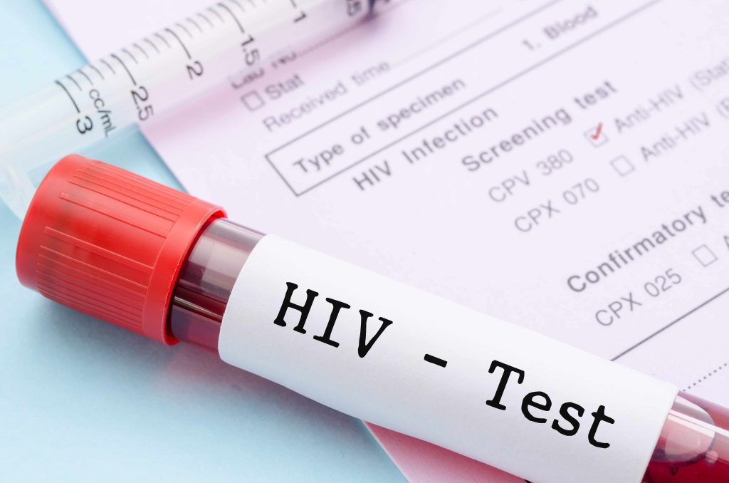 ASL L’AQUILA: AIDS, ALTA ADESIONE ALLO SCREENING, TEST SU 80 PERSONE